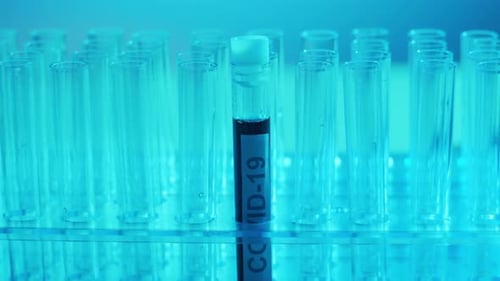 Laboratory Tubes with Blood and Virus Closeup of Scientific Lab in Hospital Epidemic Disease