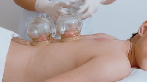 Cupping Therapy Treatment at a Healthcare Center