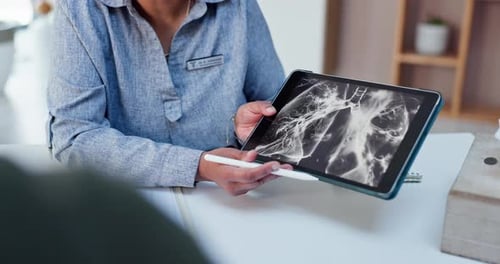 Doctor Examines Medical Scan on Tablet in Office