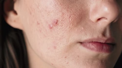 Detailed Observation of Skin with Inflammation and Scars