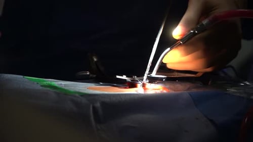 Doctor Performing Surgery with Tools Close Up