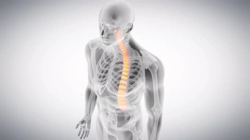 Anatomie der menschlichen Wirbelsäule mit glühenden Bandscheiben im Bewegungsablauf