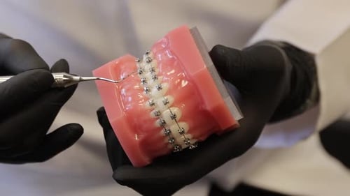 Ortodoncista demuestra cómo limpiar los aparatos dentales