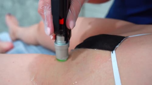 Alexandrite Laser in Aesthetic Medicine Woman on Laser Hair Removal Treatments Bikini Area