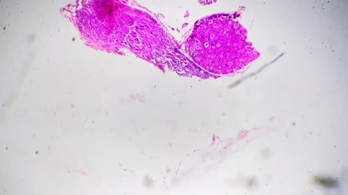 Spinal Ganglia of Human Being in Section Filmed Under Microscope with 40x Magnification