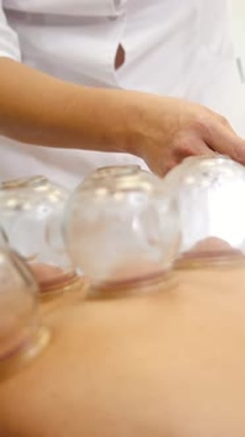 Tratamento alternativo de medicina tibetana asiática usando potes de vidro e colocação de frascos