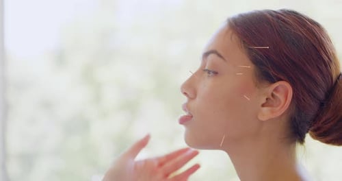 Acupuncteur caucasien d'âge mûr traitant un patient métisse en clinique