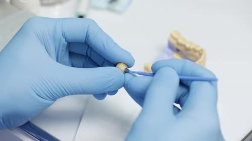 Dental Professional Working on a Tooth Crown
