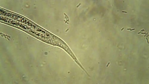Contagion Collection: Isolated microscopic worm tail gently focusing in