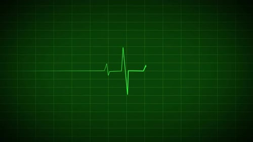 Pulsating Green ECG Line on Digital Medical Monitor