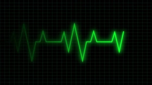 Elektrokardiogramm Heartbeat Loop Motion Graphic
