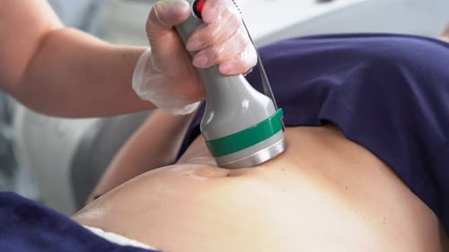 Cryolipolysis Fat Treatment Procedure in the Modern Cosmetology Clinic Non Surgical Liposuction to