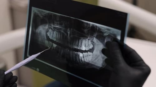 Dental Xray Dental Inspection Dental Equipment