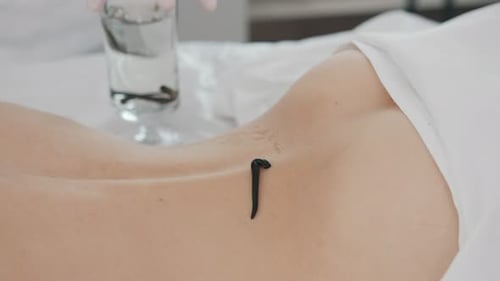 Verfahren der Hirudotherapie für blonde junge Frauen