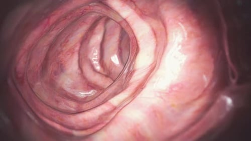 Colonoscopy Examination Healthy Human Colon Large Intestine Endoscope View 3d