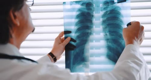 Doctor Examines Chest X-Ray in Office