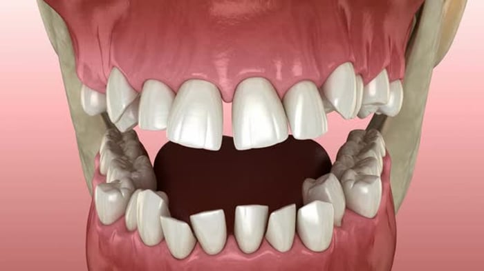 Human Jaw Anatomy and Malocclusion 3D Animation, Backgrounds Motion ...