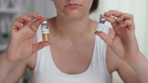 Person with Spots Holding Monkeypox Vaccine Vial