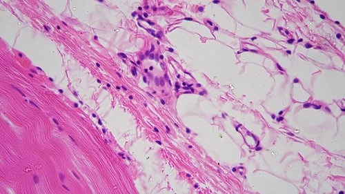 Stratified Squamous Epithelium in Section Filmed By Microscope 400x Against Bright Field
