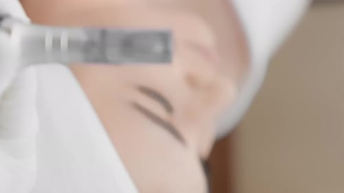 Demonstration of a Working Dermopen Closeup Before Preparing for Fractional Mesotherapy Procedure at