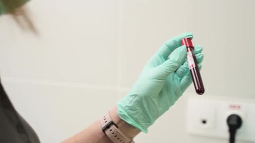 Medical Professional Holding Blood Sample in Test Tube