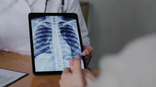 Doctor Explains Chest X-Ray to Patient