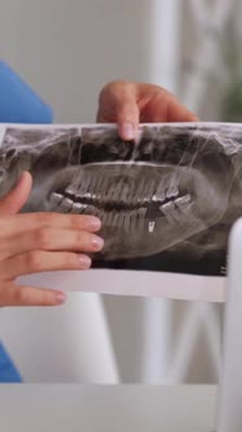 Medical Professional Examining Dental X-Ray