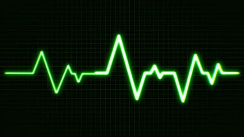 Pulse Heart Beat Animation
