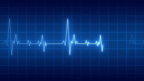 Neon Electrocardiogram Heartbeat Pulse monitor Medical Display Background Loop v2