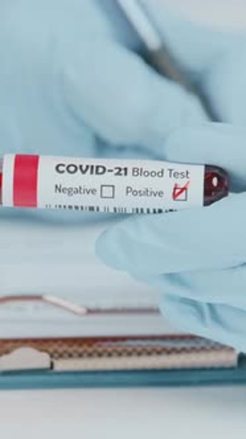 Positive COVID-21 Blood Test in Medical Lab