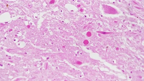 Section of Human Medulla Oblongata Filmed Under Microscope 400x on Bright Field