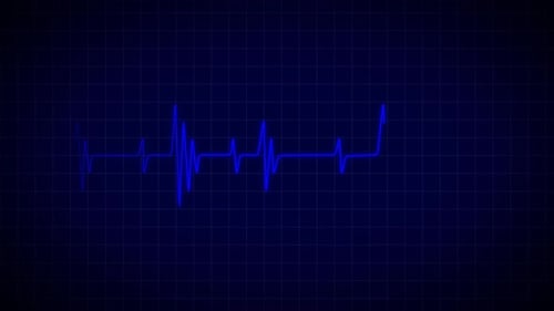 Digital Blue Heartbeat Line Animation on Grid Background