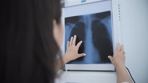 Doctor Examining Chest Xray Image on Lightbox
