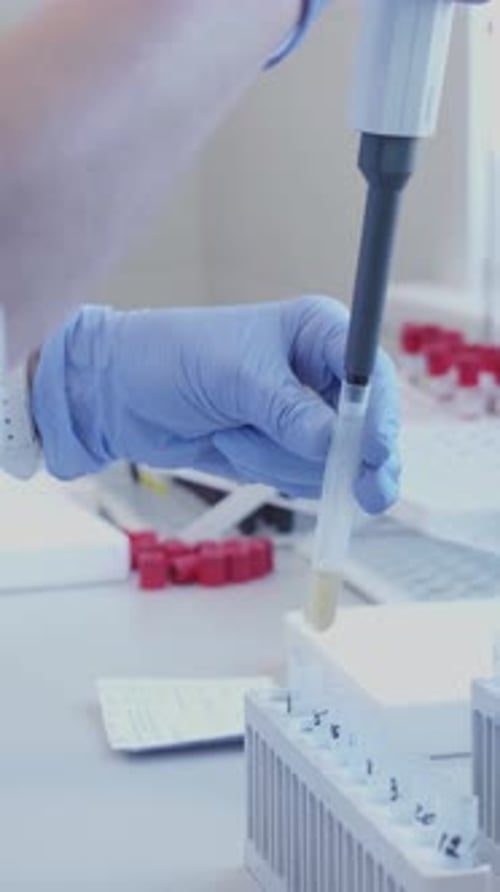 Lab Technician Handles Test Tubes in the Hospital