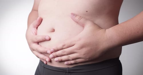 Hombre con barriga gorda que sufre un trastorno metabólico, resección del estómago, liposucción. lowmotion