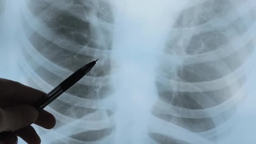 Doctor examining Fluorography