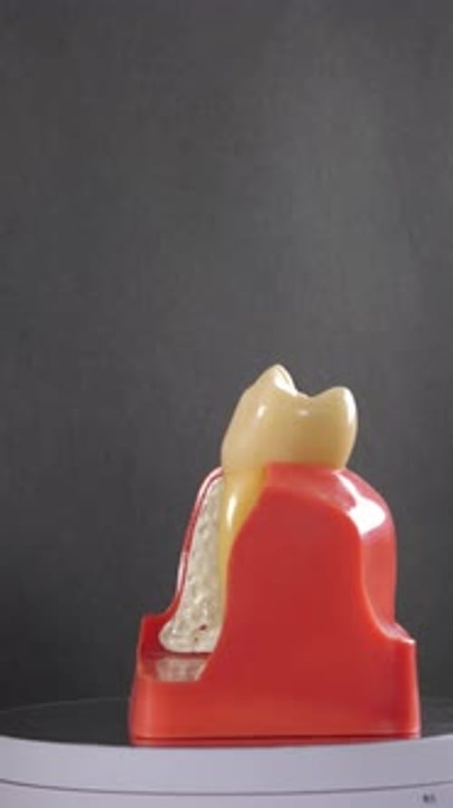Dental Implant Demonstration with Jaw Model on Rotating Stand