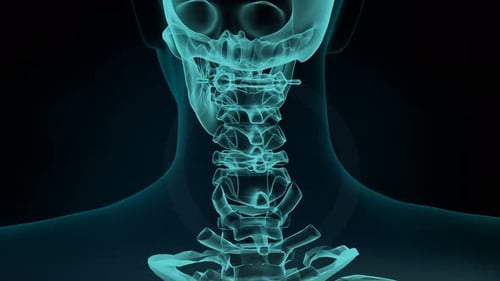 3d Rendered Illustration Of A Painful Neck Joint. Medical Concept, 4k Animation.