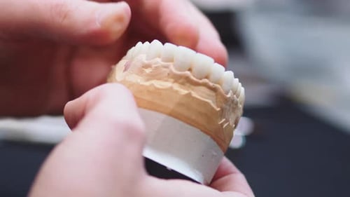 In Clinic Dentist Hands Setting Dental Tooth Crown on Jaw Model Working on Dentures Use Instrument