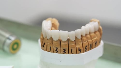 Dental Model with Artificial Teeth in Medical Setting