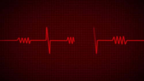 Animated Red ECG Heartbeat Monitor Line Loop