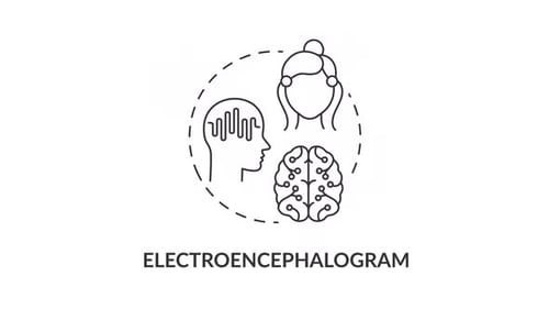 Electroencephalogram concept icon line animation