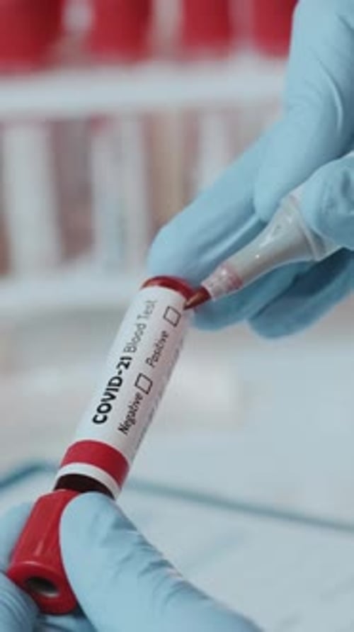 Marking Blood Test Positive for COVID-21