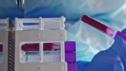 Blood Sample Test in Hospital Laboratory