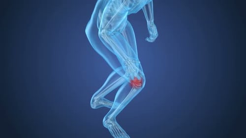 Knee pain Attack, man suffering from spinal knee. 3D animation