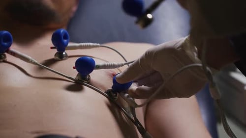 Performing an EKG Test Understanding Electrocardiogram Procedures and Heart Health Monitoring