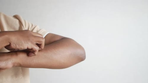 Man Suffering From Itching Skin Close Up