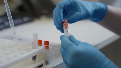 Hands Examine Vial in Medical Setting