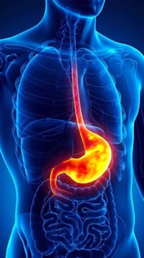 Acid Reflux - Esophageal Inflammation Thermal Map 3D Animation | Manestream Den