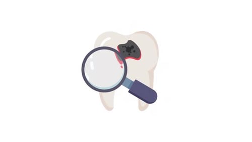 Cavity Element Alpha Animation